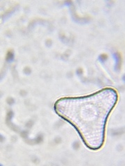 Staurastrum striolatum