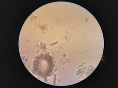 Ramularia cylindroides