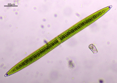 Closterium acerosum