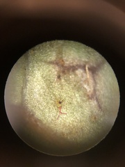 Mycosphaerella chimaphilae