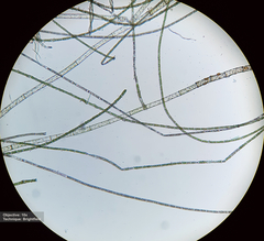 Rhizoclonium