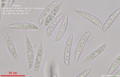 Hymenoscyphus scutula