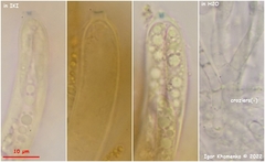 Hymenoscyphus scutula
