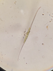 Closterium kuetzingii