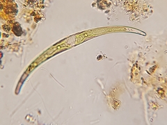Closterium parvulum