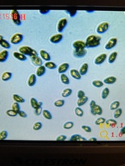 Cortinarius cyanites