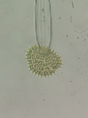 Pseudopediastrum boryanum