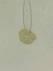 Pseudopediastrum boryanum