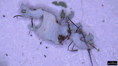 Heterodermia squamulosa