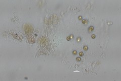 Sphaerocystis