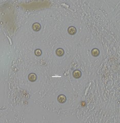 Sphaerocystis