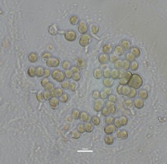 Sphaerocystis