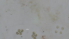 Asterococcus