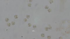 Asterococcus