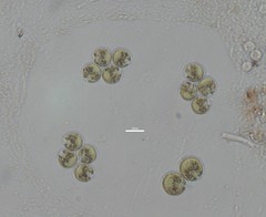 Asterococcus