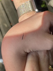 Hydrometra stagnorum