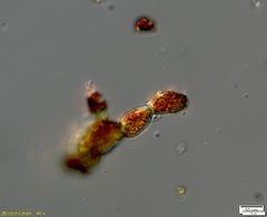 Trentepohlia umbrina