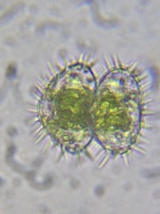 Staurastrum polytrichum