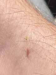 Macrosiphum euphorbiae