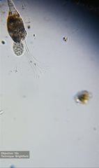 Collotheca