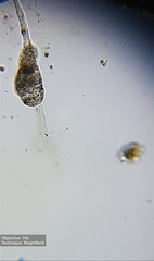 Collotheca