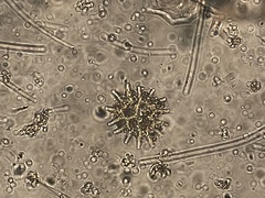 Pseudopediastrum boryanum
