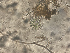 Pseudopediastrum boryanum