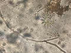 Pseudopediastrum boryanum
