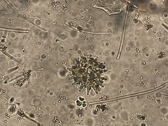 Pseudopediastrum boryanum