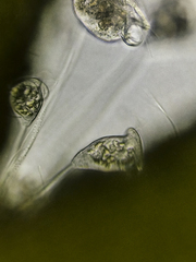 Vorticellidae