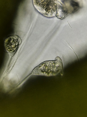 Vorticellidae