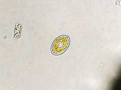 Cocconeis