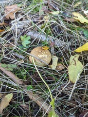 Scleroderma