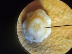 Ceroplastes