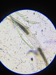 Closterium abruptum
