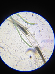 Closterium abruptum