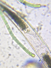 Closterium abruptum