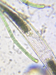Closterium abruptum
