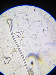 Staurastrum hystrix