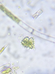 Staurastrum polytrichum