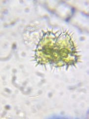 Staurastrum polytrichum