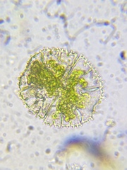 Micrasterias truncata