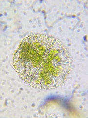 Micrasterias truncata