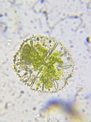 Micrasterias truncata