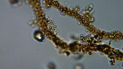 Anthophysa