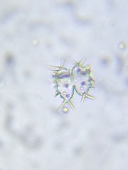 Staurastrum hystrix