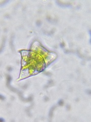 Staurodesmus dejectus