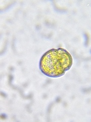 Parvodinium inconspicuum