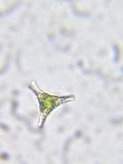 Staurastrum anatinum