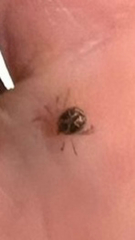 Ixodidae